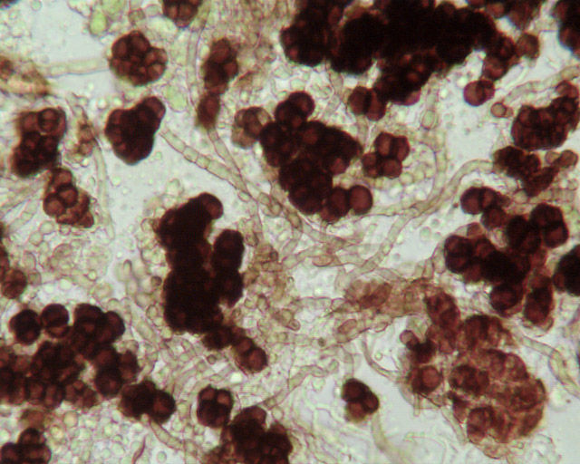 Представитель Семейства Capnodiaceae